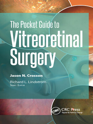 cover image of The Pocket Guide to Vitreoretinal Surgery